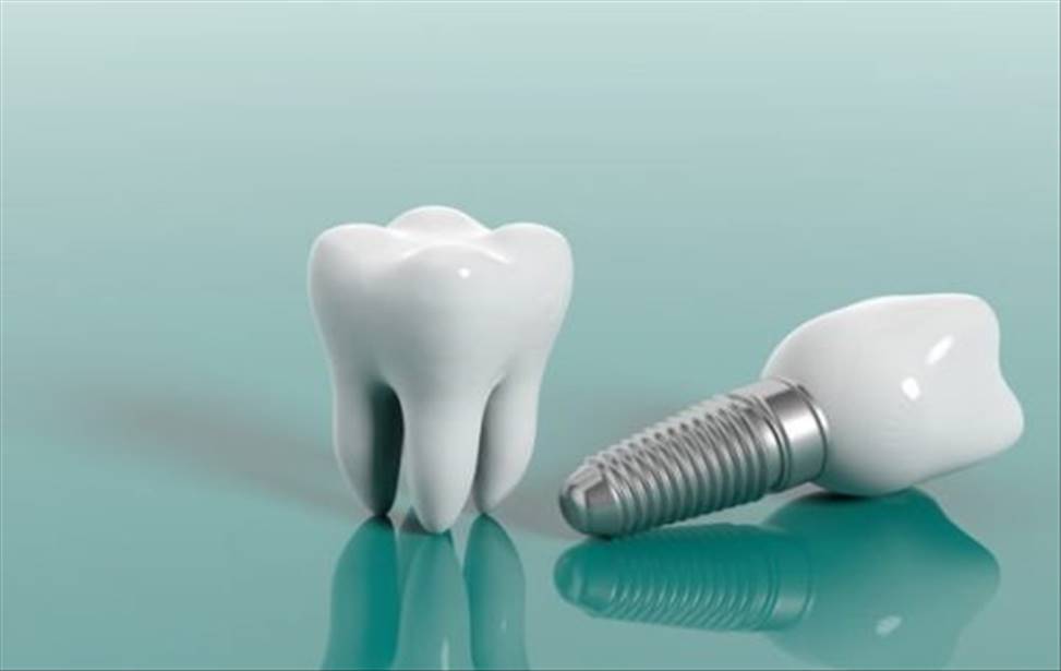 implant